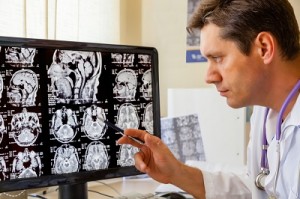 Dairy affects your brain
